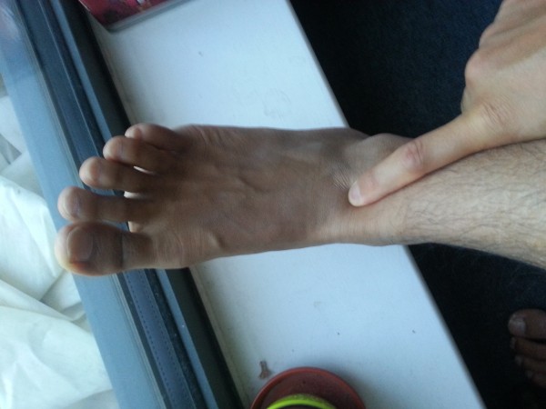 ankle.jpg