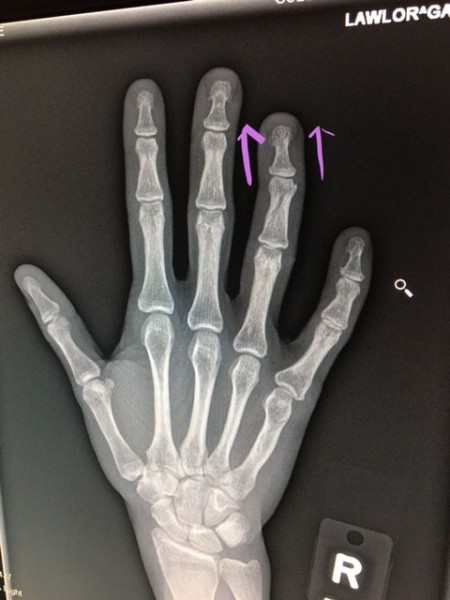hand.jpg