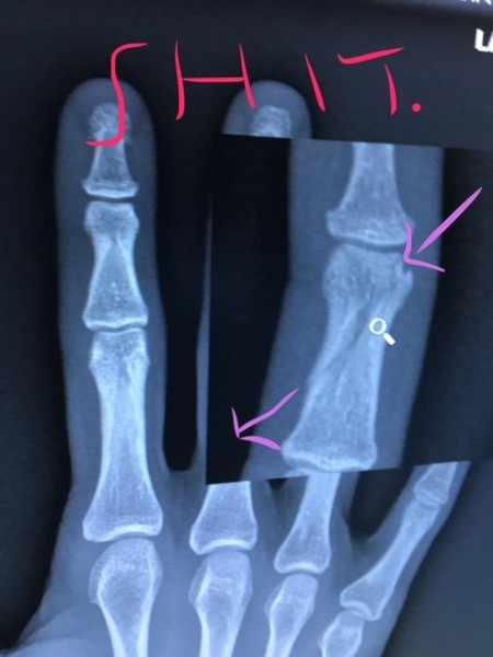 finger.jpg