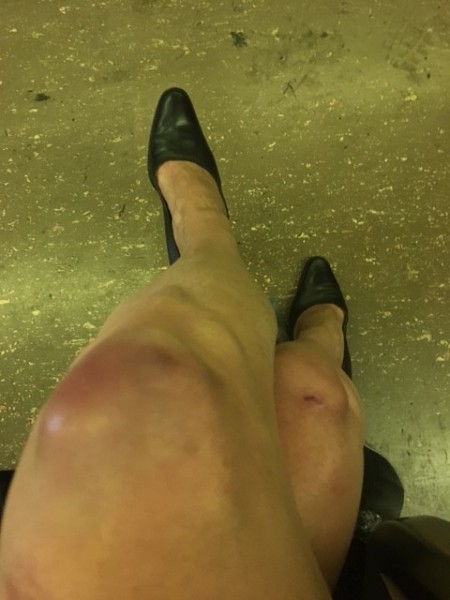 knees.jpg