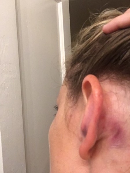 ear.jpg