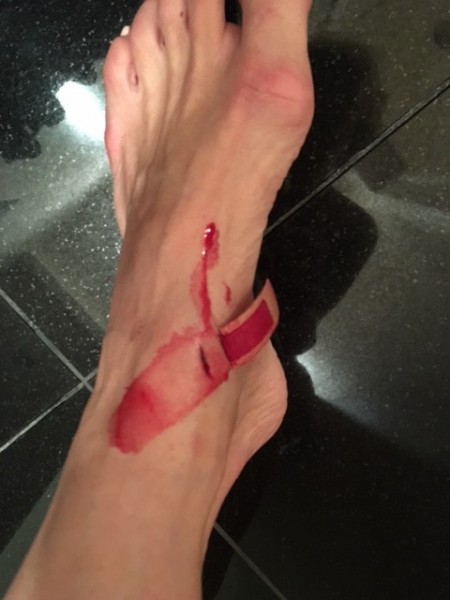 ouch2.jpg