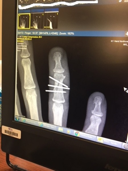 finger 2.jpg